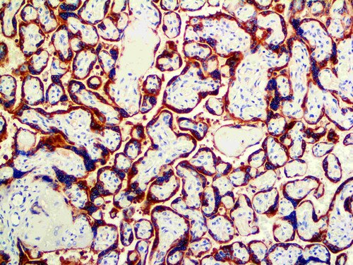 IHC of hPL on a FFPE Placenta Tissue